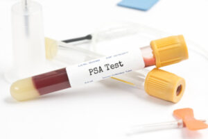 psa testi