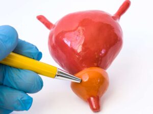Prostat Belirtileri Nelerdir?