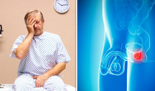 Prostat Kanseri Evrelemesi Nasıl Yapılır?