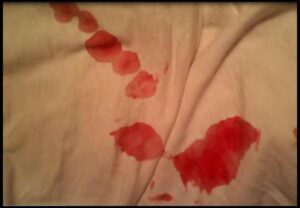 Menide Kan Görülmesi