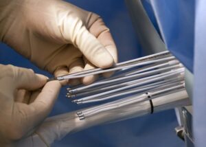 Prostat kanserinde brakiterapi