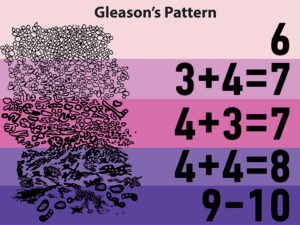 Gleason Skoru