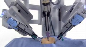 Prostat Kanserinde Robotik Cerrahi